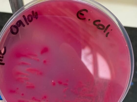 Bactéria comum, risco real